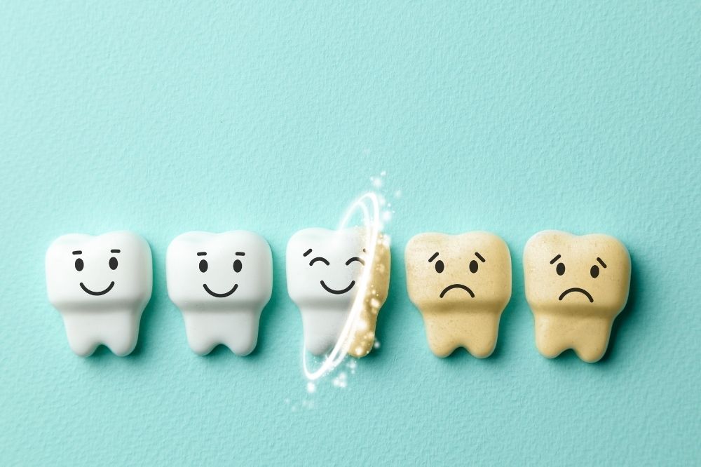 Du carbonate de calcium pour des dents plus blanches